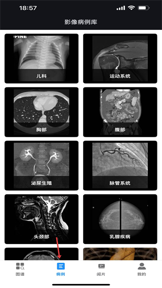 医学影像解剖图谱 病例库 科室分类 影像分析