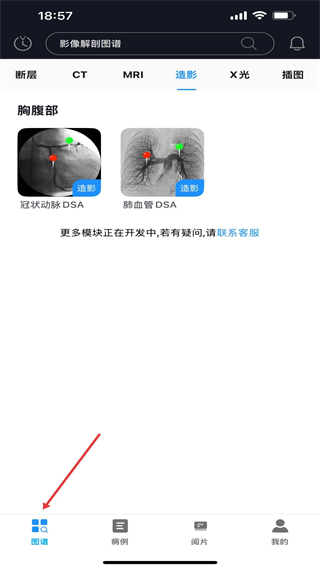 医学影像解剖图谱 图谱板块 胸腹造影 DSA影像